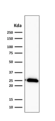 Western blot - Anti-Bcl-2 antibody [BCL2/2210R] (AB238041)