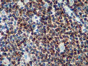 Immunohistochemistry (Formalin/PFA-fixed paraffin-embedded sections) - Anti-Bcl-2 antibody [E17] (AB32124)