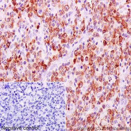 Immunohistochemistry (Formalin/PFA-fixed paraffin-embedded sections) - Anti-Bcl-2 antibody [E17] (AB32124)