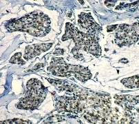Immunohistochemistry (Formalin/PFA-fixed paraffin-embedded sections) - Anti-Bcl-2 antibody [E17] (AB32124)