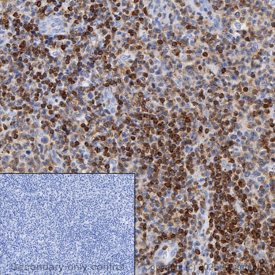 Immunohistochemistry (Formalin/PFA-fixed paraffin-embedded sections) - Anti-Bcl-2 antibody [E17] (ab32124), expandable thumbnail
