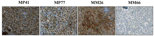 Immunohistochemistry (Formalin/PFA-fixed paraffin-embedded sections) - Anti-Bcl-2 antibody [E17] (AB32124)