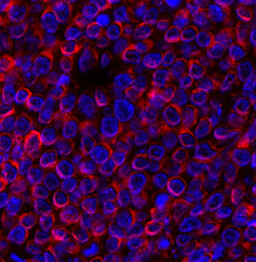 Immunohistochemistry (Formalin/PFA-fixed paraffin-embedded sections) - Anti-Bcl-2 antibody [E17] (AB32124)