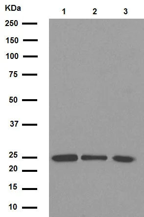 Western blot - Anti-Bcl-2 antibody [E17] (AB32124)