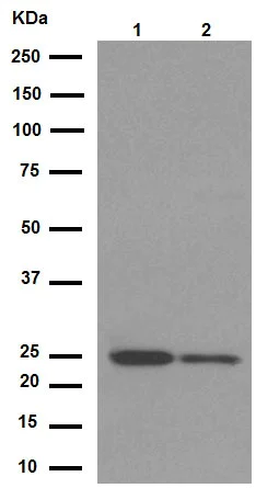 Western blot - Anti-Bcl-2 antibody [E17] (AB32124)