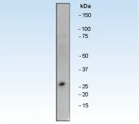 Western blot - Anti-Bcl-2 antibody [E17] (AB32124)