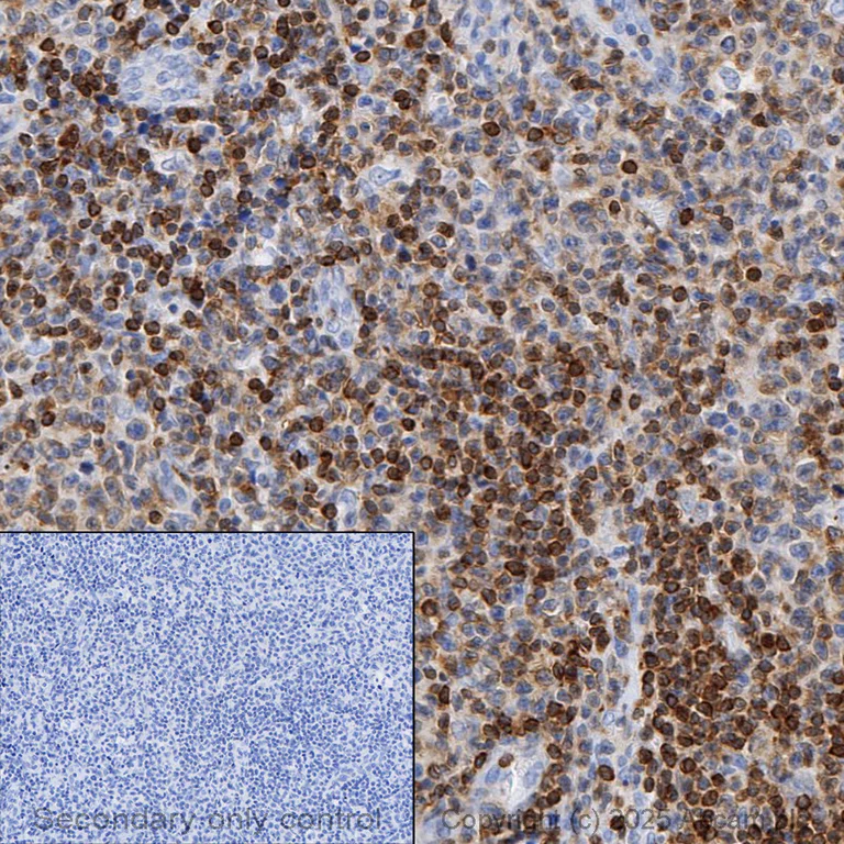 Immunohistochemistry (Formalin/PFA-fixed paraffin-embedded sections) - Anti-Bcl-2 antibody [E17] - BSA and Azide free (AB185002)