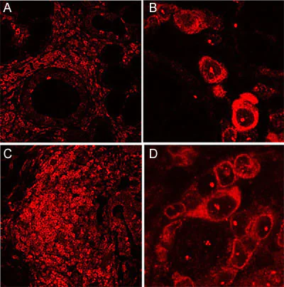 Immunohistochemistry (Formalin/PFA-fixed paraffin-embedded sections) - Anti-Bcl-2 antibody [E17] - BSA and Azide free (AB185002)