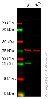 Western blot - Anti-Bcl-2 antibody [E17] - BSA and Azide free (AB185002)