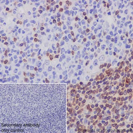 Immunohistochemistry (Formalin/PFA-fixed paraffin-embedded sections) - Anti-Bcl-2 antibody [EPR17509] (AB182858)