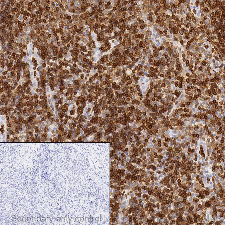Immunohistochemistry (Formalin/PFA-fixed paraffin-embedded sections) - Anti-Bcl-2 antibody [EPR17509] (AB182858)