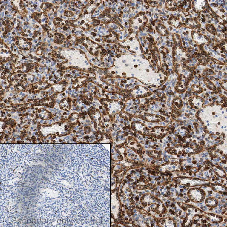 Immunohistochemistry (Formalin/PFA-fixed paraffin-embedded sections) - Anti-Bcl-2 antibody [EPR17509] (AB182858)