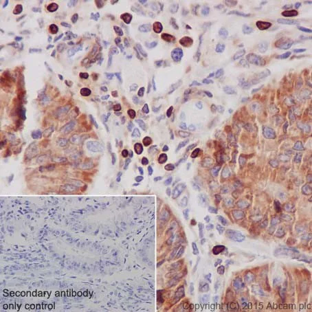 Immunohistochemistry (Formalin/PFA-fixed paraffin-embedded sections) - Anti-Bcl-2 antibody [EPR17509] - BSA and Azide free (AB219608)