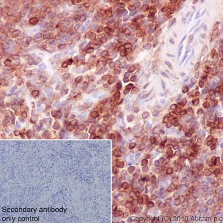 Immunohistochemistry (Formalin/PFA-fixed paraffin-embedded sections) - Anti-Bcl-2 antibody [EPR17509] - BSA and Azide free (AB219608)