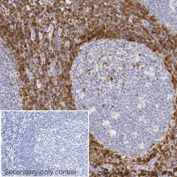 Immunohistochemistry (Formalin/PFA-fixed paraffin-embedded sections) - Anti-Bcl-2 antibody [NOR 235J] (AB241548)