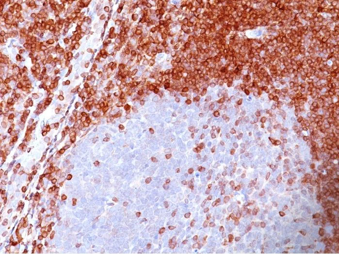 Immunohistochemistry (Formalin/PFA-fixed paraffin-embedded sections) - Anti-Bcl-2 antibody [SPM117] (AB270252)