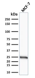 Western blot - Anti-Bcl-2 antibody [SPM117] (AB270252)