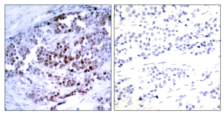 Immunohistochemistry (Formalin/PFA-fixed paraffin-embedded sections) - Anti-Bcl-2 (phospho S70) antibody (AB28819)