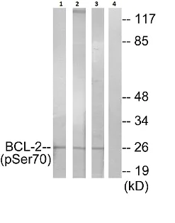 Western blot - Anti-Bcl-2 (phospho S70) antibody (AB28819)
