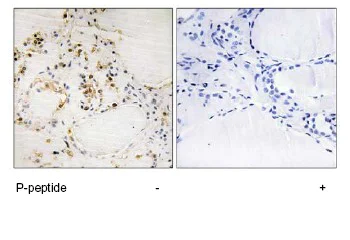 Immunohistochemistry (Formalin/PFA-fixed paraffin-embedded sections) - Anti-Bcl-2 (phospho S87) antibody (AB73985)