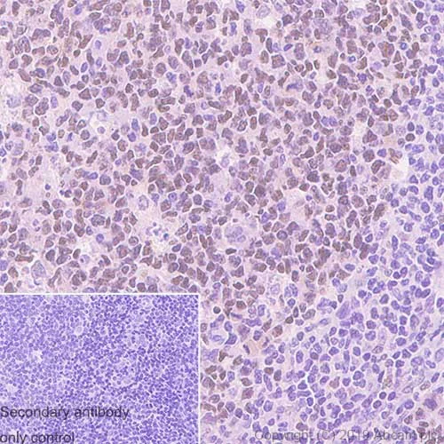 Immunohistochemistry (Formalin/PFA-fixed paraffin-embedded sections) - Anti-Bcl 7A antibody [15C] - BSA and Azide free (AB252800)