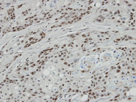 Immunohistochemistry (Formalin/PFA-fixed paraffin-embedded sections) - Anti-Bcl 7A antibody - C-terminal (AB137362), expandable thumbnail