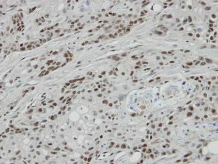 Immunohistochemistry (Formalin/PFA-fixed paraffin-embedded sections) - Anti-Bcl 7A antibody - C-terminal (AB137362)