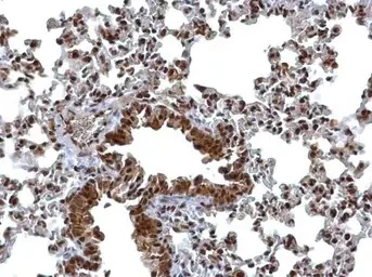Immunohistochemistry (Formalin/PFA-fixed paraffin-embedded sections) - Anti-Bcl 7A antibody - C-terminal (AB137362)