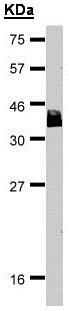 Western blot - Anti-Bcl 7A antibody - C-terminal (AB137362), expandable thumbnail