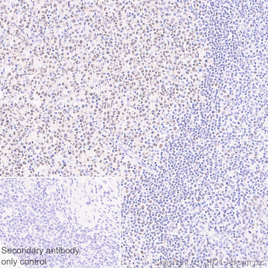 Immunohistochemistry (Formalin/PFA-fixed paraffin-embedded sections) - Anti-Bcl 7A antibody [EPR24162-226] (ab259833), expandable thumbnail