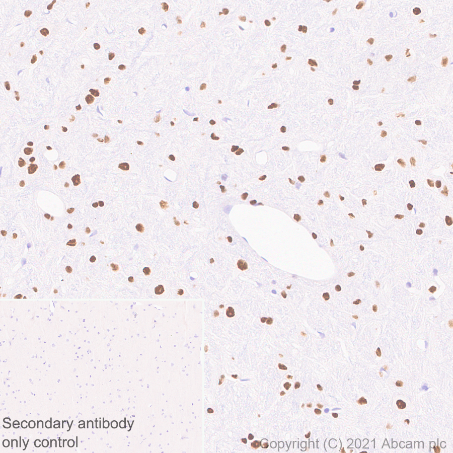 Immunohistochemistry (Formalin/PFA-fixed paraffin-embedded sections) - Anti-Bcl 7A antibody [EPR24162-226] (ab259833), expandable thumbnail