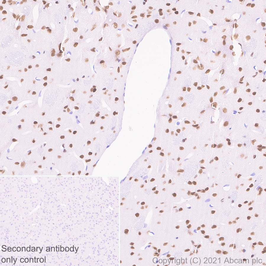 Immunohistochemistry (Formalin/PFA-fixed paraffin-embedded sections) - Anti-Bcl 7A antibody [EPR24162-226] (ab259833), expandable thumbnail