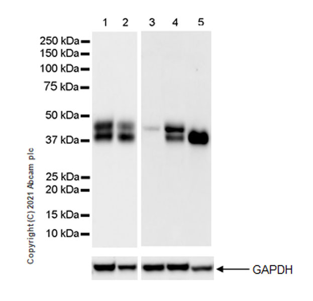 Western blot - Anti-Bcl 7A antibody [EPR24162-226] (AB259833), expandable thumbnail