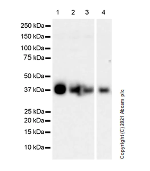 Western blot - Anti-Bcl 7A antibody [EPR24162-226] (AB259833)