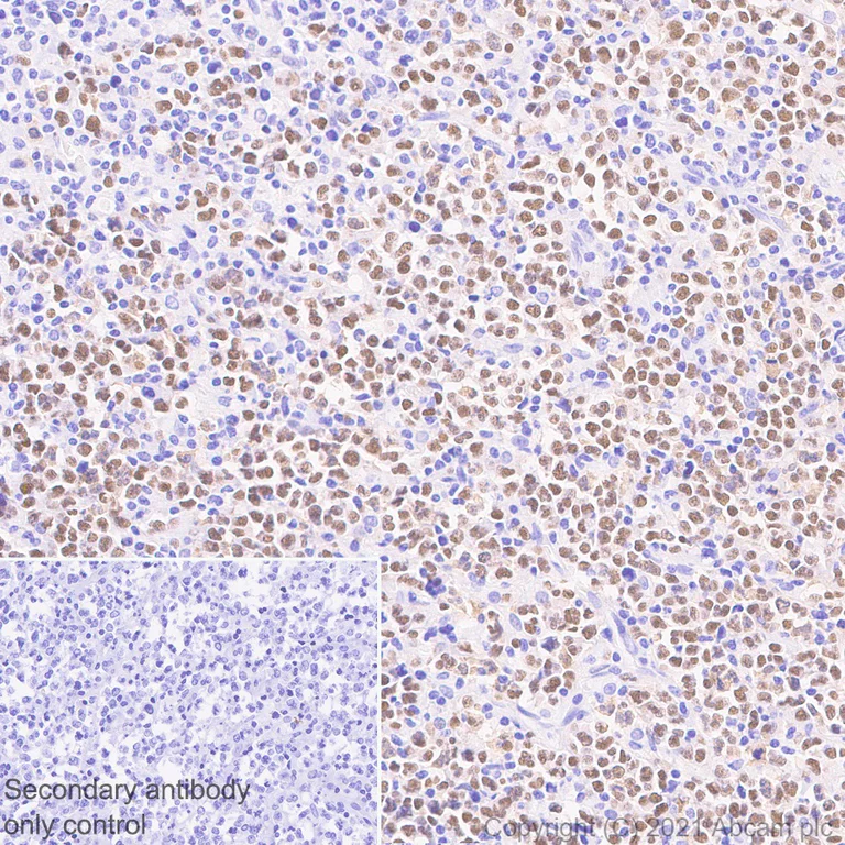 Immunohistochemistry (Formalin/PFA-fixed paraffin-embedded sections) - Anti-Bcl 7A antibody [EPR24162-226] - BSA and Azide free (AB282012)