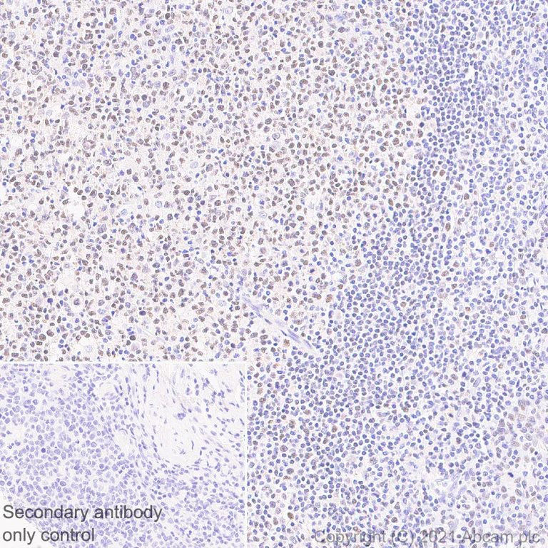 Immunohistochemistry (Formalin/PFA-fixed paraffin-embedded sections) - Anti-Bcl 7A antibody [EPR24162-226] - BSA and Azide free (AB282012)