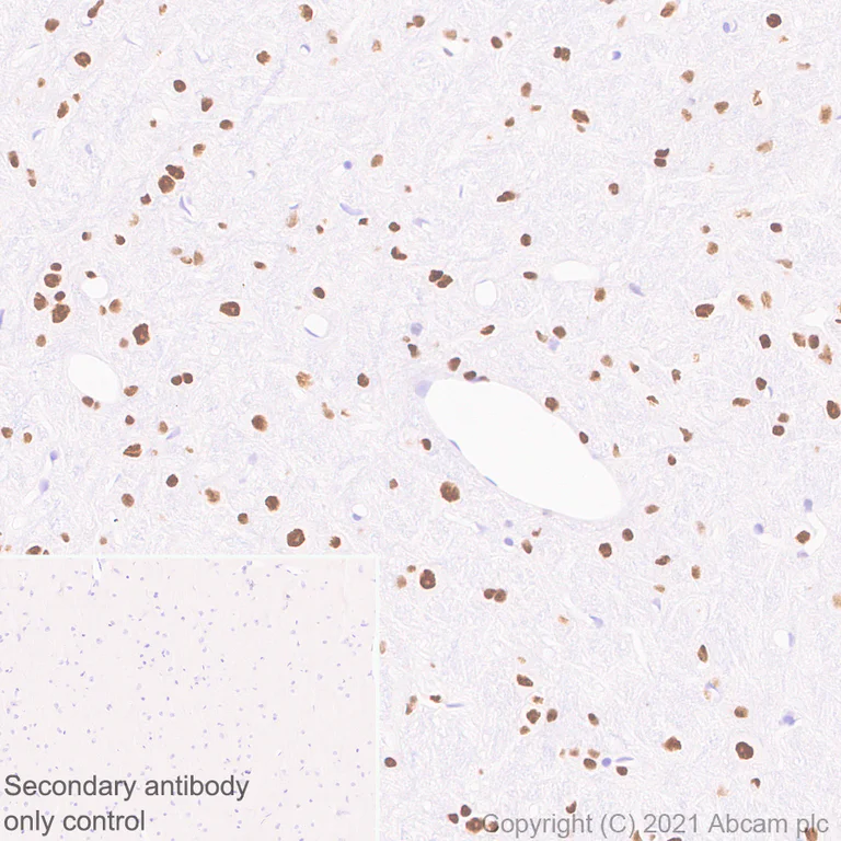 Immunohistochemistry (Formalin/PFA-fixed paraffin-embedded sections) - Anti-Bcl 7A antibody [EPR24162-226] - BSA and Azide free (AB282012)