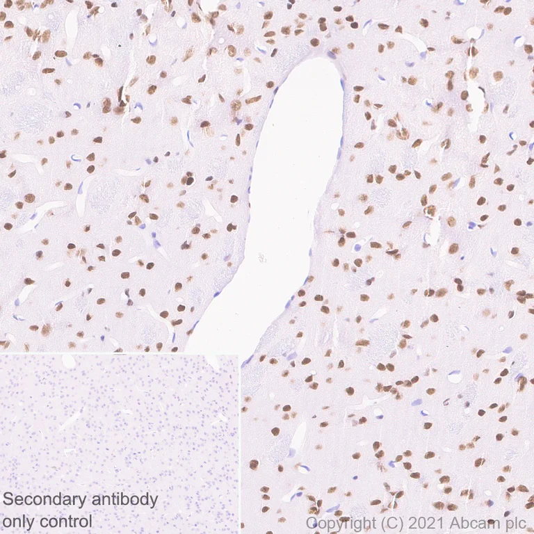 Immunohistochemistry (Formalin/PFA-fixed paraffin-embedded sections) - Anti-Bcl 7A antibody [EPR24162-226] - BSA and Azide free (AB282012)