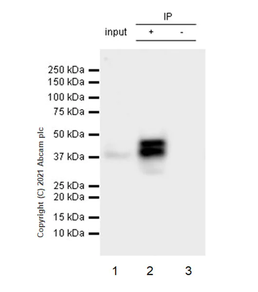 Immunoprecipitation - Anti-Bcl 7A antibody [EPR24162-226] - BSA and Azide free (AB282012)