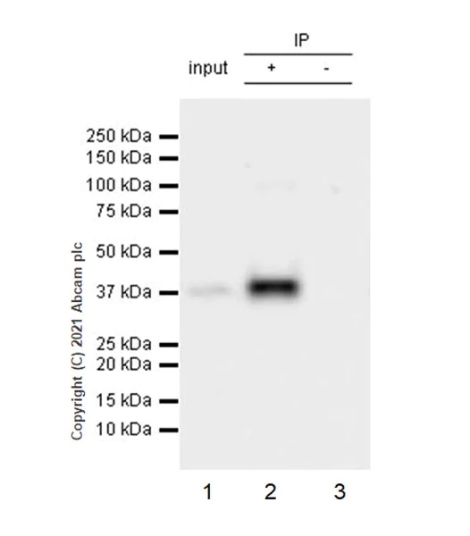 Immunoprecipitation - Anti-Bcl 7A antibody [EPR24162-226] - BSA and Azide free (AB282012)