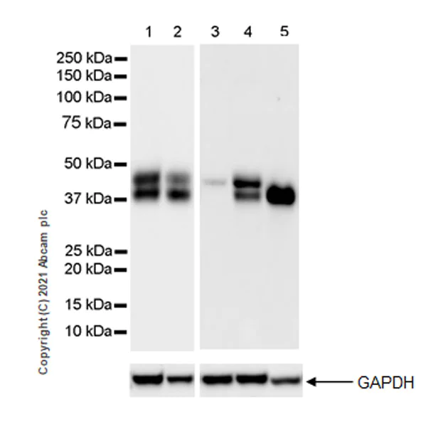 Western blot - Anti-Bcl 7A antibody [EPR24162-226] - BSA and Azide free (AB282012)