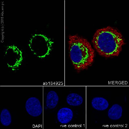 Immunocytochemistry/ Immunofluorescence - Anti-Bcl G/BCL2L14 antibody [EPR17666] (AB184925), expandable thumbnail