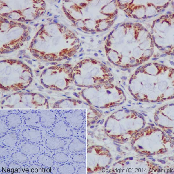 Immunohistochemistry (Formalin/PFA-fixed paraffin-embedded sections) - Anti-Bcl G/BCL2L14 antibody [EPR17666] (ab184925), expandable thumbnail