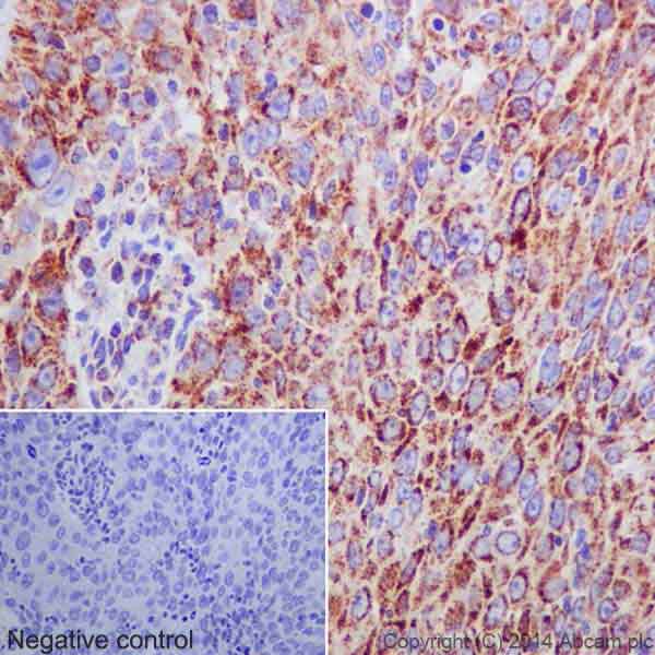Immunohistochemistry (Formalin/PFA-fixed paraffin-embedded sections) - Anti-Bcl G/BCL2L14 antibody [EPR17666] (ab184925), expandable thumbnail