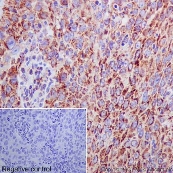 Immunohistochemistry (Formalin/PFA-fixed paraffin-embedded sections) - Anti-Bcl G/BCL2L14 antibody [EPR17666] (AB184925)