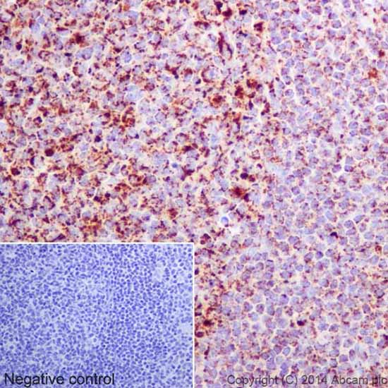 Immunohistochemistry (Formalin/PFA-fixed paraffin-embedded sections) - Anti-Bcl G/BCL2L14 antibody [EPR17666] (AB184925), expandable thumbnail