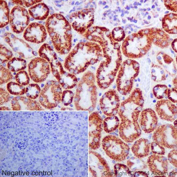 Immunohistochemistry (Formalin/PFA-fixed paraffin-embedded sections) - Anti-Bcl G/BCL2L14 antibody [EPR17666] (ab184925), expandable thumbnail