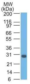 Western blot - Anti-Bcl-XL antibody [2H12] (AB270253)