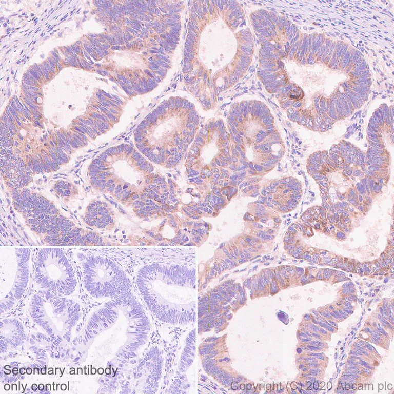 Immunohistochemistry (Formalin/PFA-fixed paraffin-embedded sections) - Anti-Bcl-XL antibody [2H12] (AB77571)