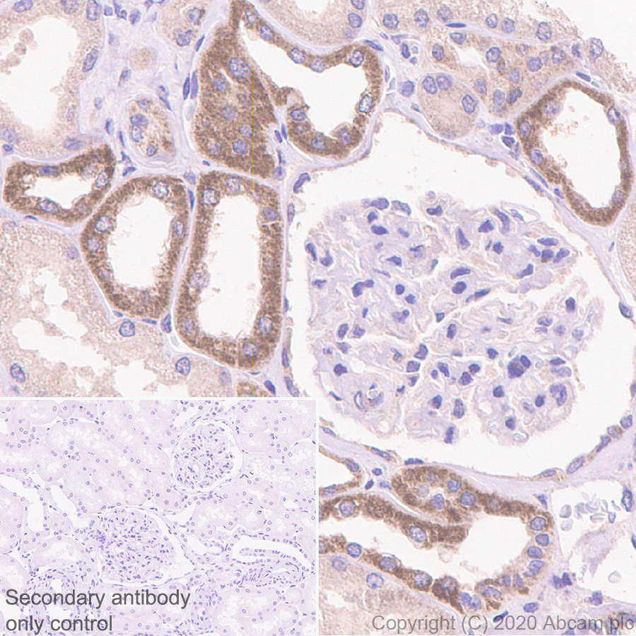 Immunohistochemistry (Formalin/PFA-fixed paraffin-embedded sections) - Anti-Bcl-XL antibody [2H12] - BSA and Azide free (AB252257), expandable thumbnail